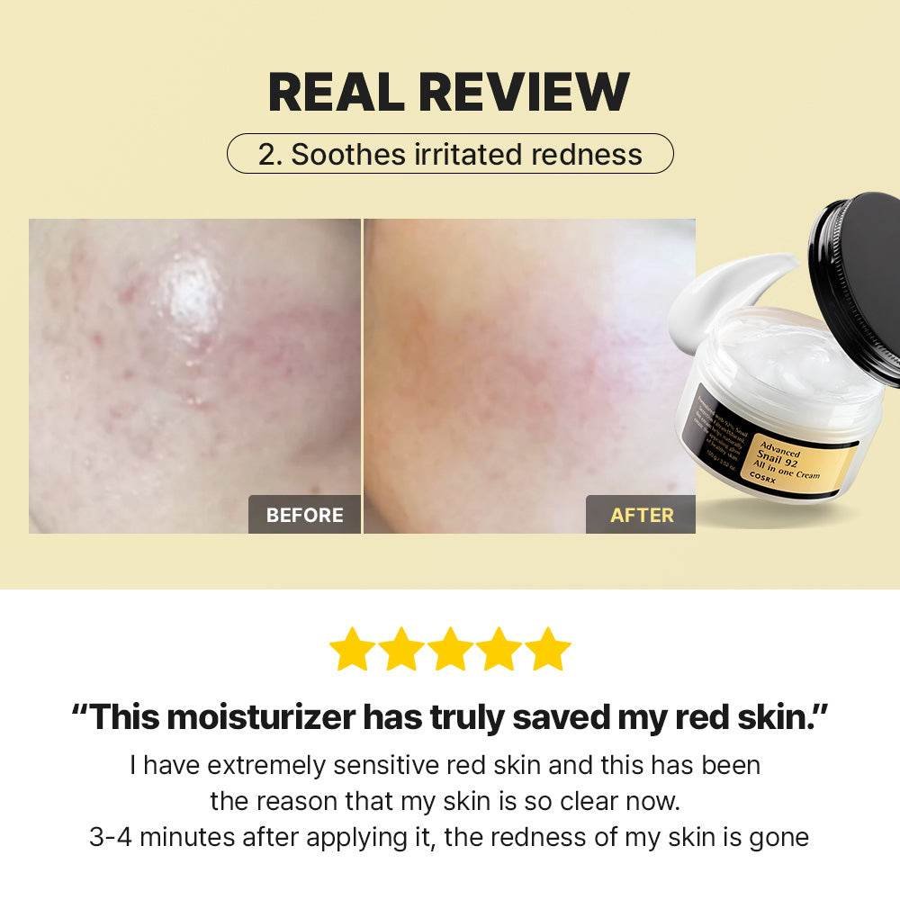 ✨ cosrx snail 92 – for the glow you deserve ✨ ✨ cosrx snail 92 – for the glow you deserve ✨